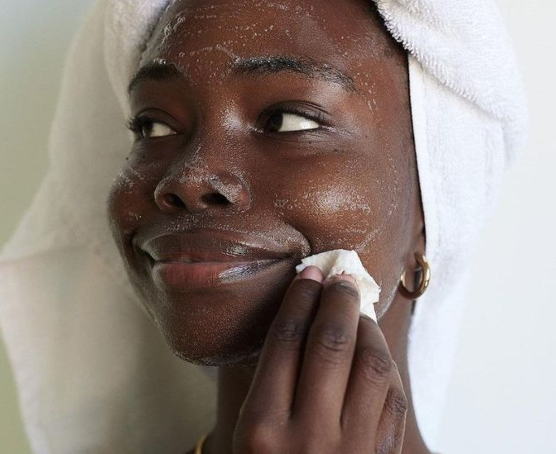 IS YOUR ACNE GETTING WORSE?