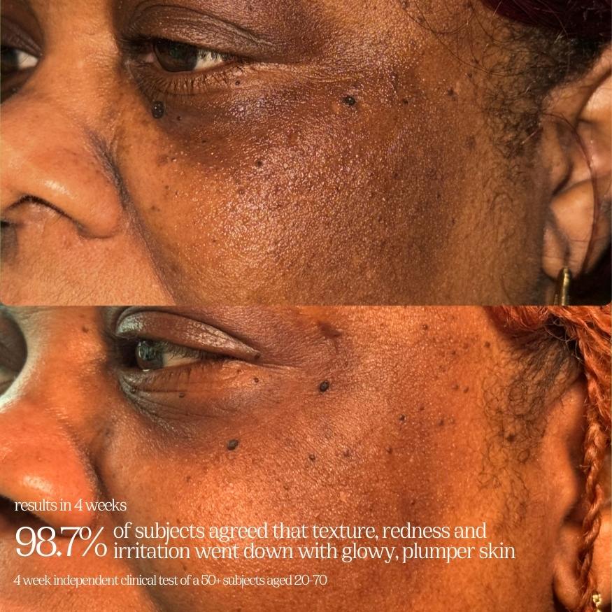 MENOPAUSE SOLUTION SET