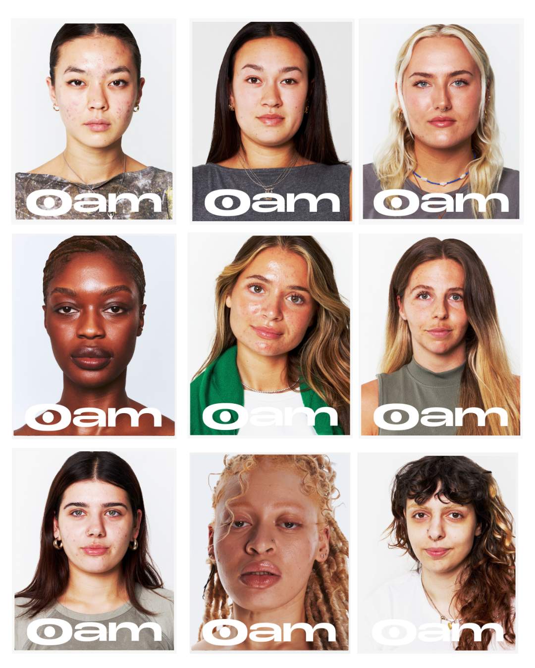 HOT GIRLS HAVE ACNE: REAL STORIES OF TRANSFORMATION + SELF LOVE