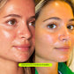 CRYSTAL-CLEAR SPOT + PIGMENTATION TREATMENT