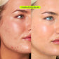 CRYSTAL-CLEAR SPOT + PIGMENTATION TREATMENT