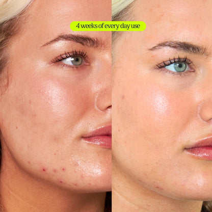 CRYSTAL-CLEAR SPOT + PIGMENTATION TREATMENT