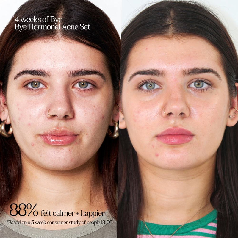 Hormone Check Drops by Eyeam – eyeam