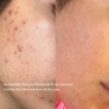 CRYSTAL-CLEAR SPOT + PIGMENTATION TREATMENT