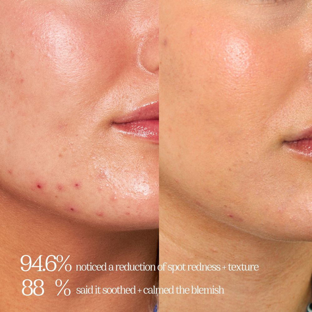 CRYSTAL-CLEAR SPOT + PIGMENTATION TREATMENT