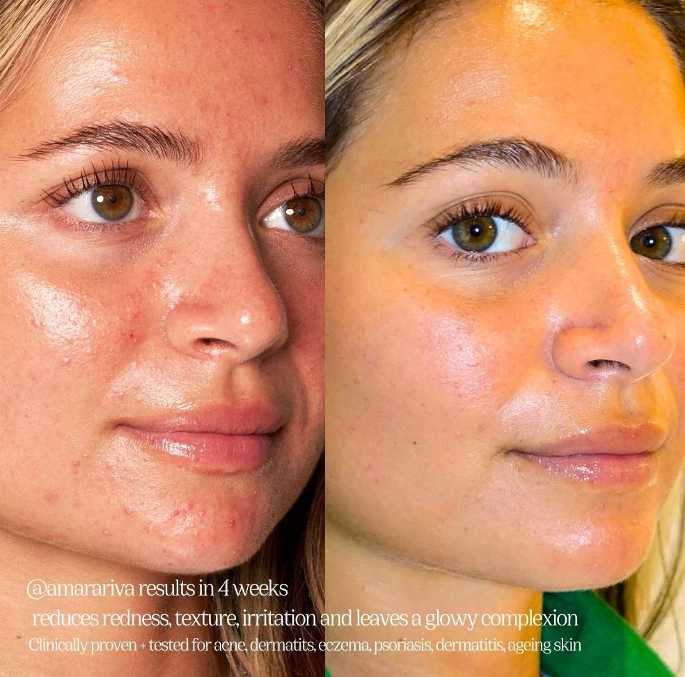 CLEAR SKIN SOLUTION SET